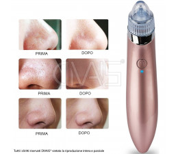 Aspiratore facciale portatile 2