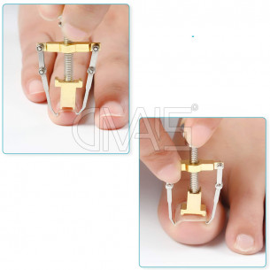 Stumento Per Unghia Incarnita 2